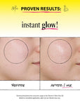 Before and after comparison of skin with a product application, labeled 'Proven Results: Instant Glow'.