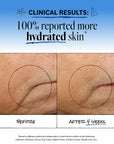 Before and after comparison of hydrated skin with clinical results text on a blue background.