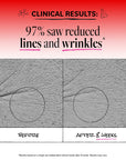 Anti-Wrinkle Retinol Night Treatment