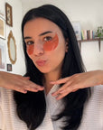Woman with orange patches on her face pointing to them in a room with decor.