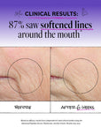 Advanced Peptides and Flora-Collagen™ Serum