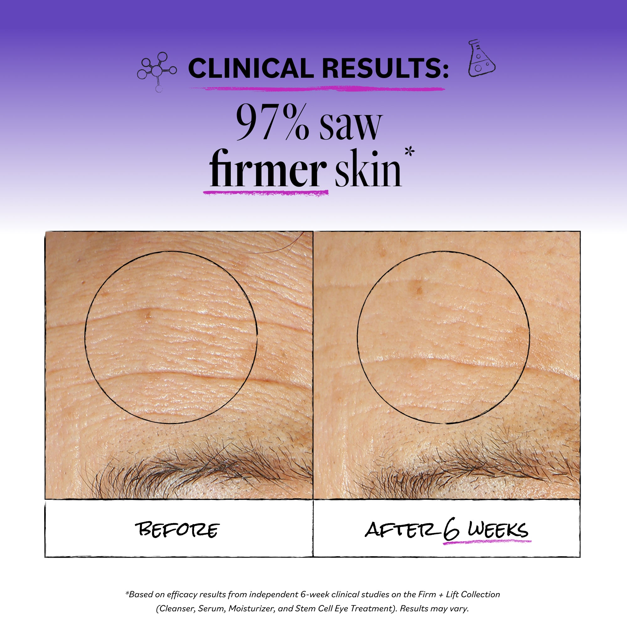 DERMA E | Ultra Lift Firming DMAE Moisturizer