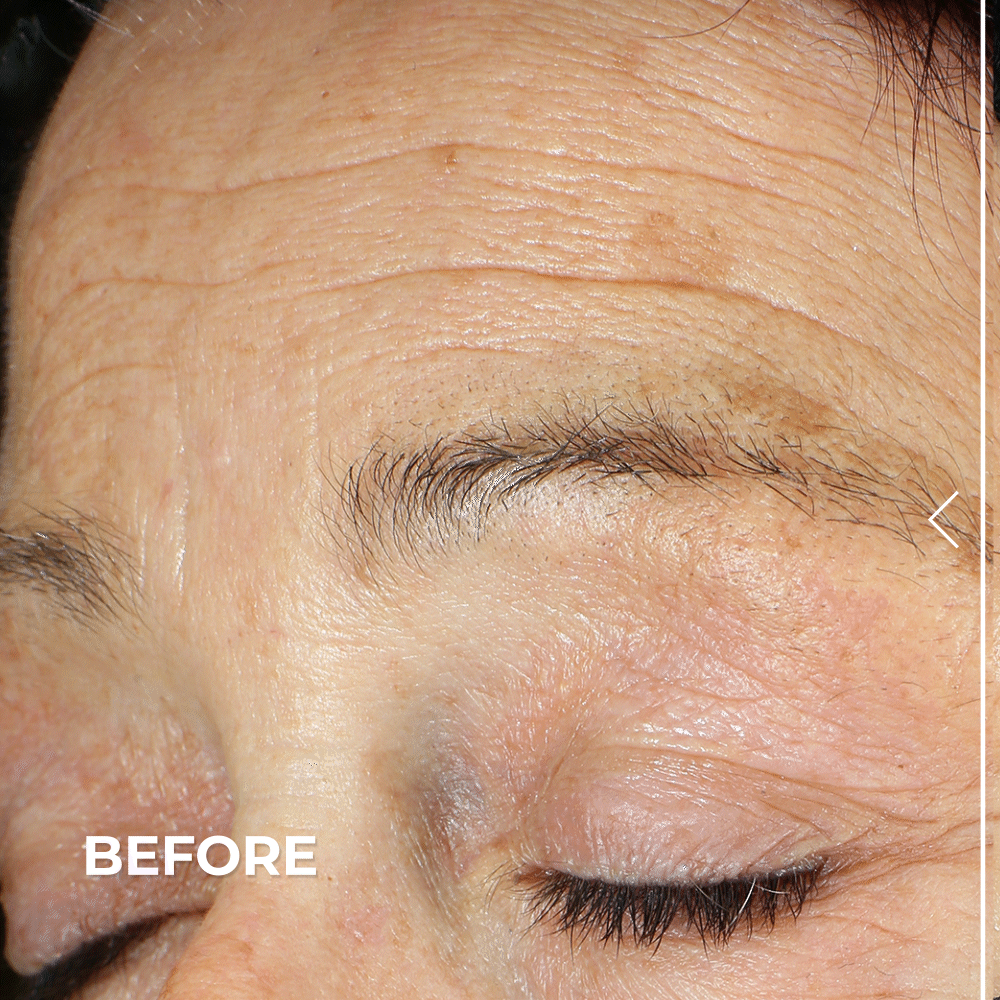 Ultra Lift DMAE Concentrated Serum