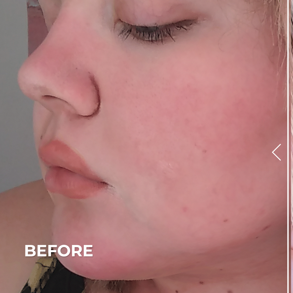 Pure Biome before and after result photo
