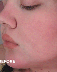 Pure Biome before and after result photo