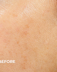 Before & After Vitamin C Use