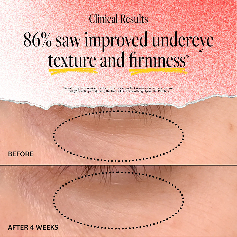 Retinol Line Smoothing Hydro Gel Patches (30 pack)