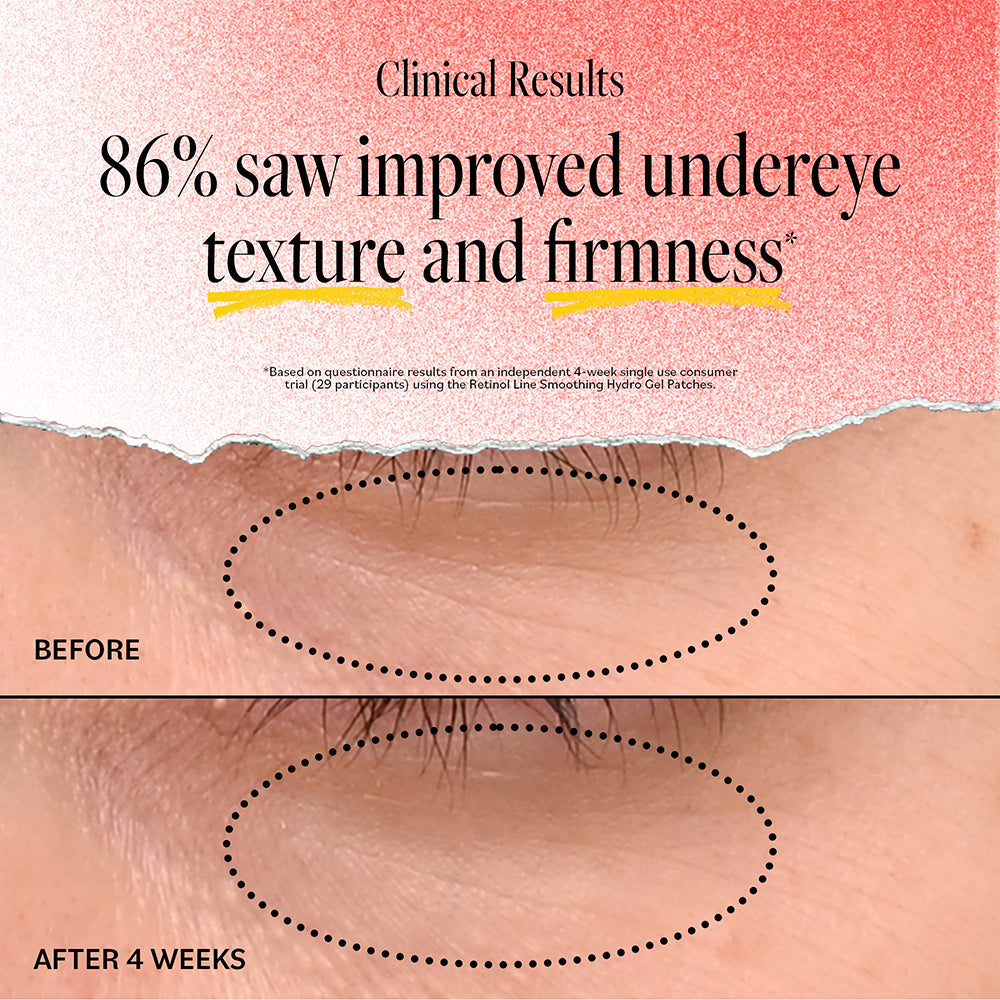 Retinol Line Smoothing Hydro Gel Patches (5 pack)