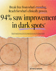 94% saw improvement in dark spots' and side-by-side comparison of skin before and after 8 weeks, with dotted circles highlighting areas of improvement.