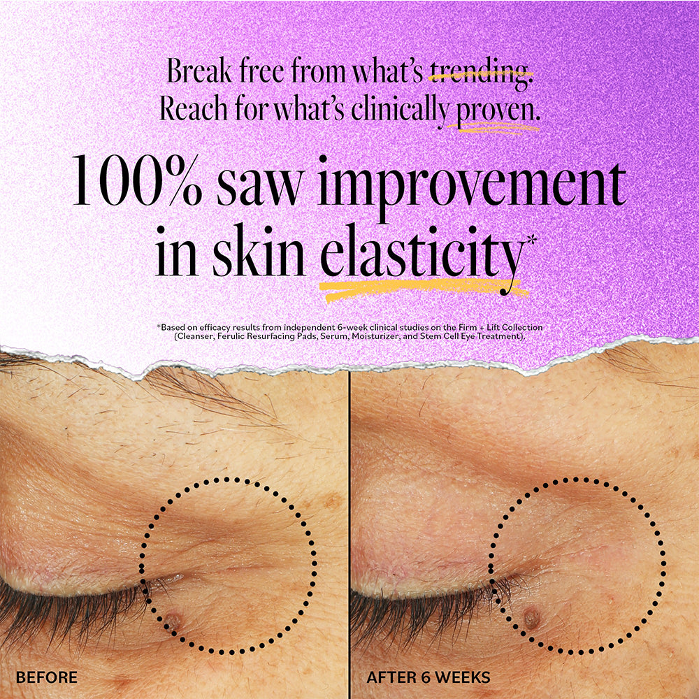Stem Cell Eye Lifting Treatment