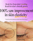 Stem Cell Eye Lifting Treatment