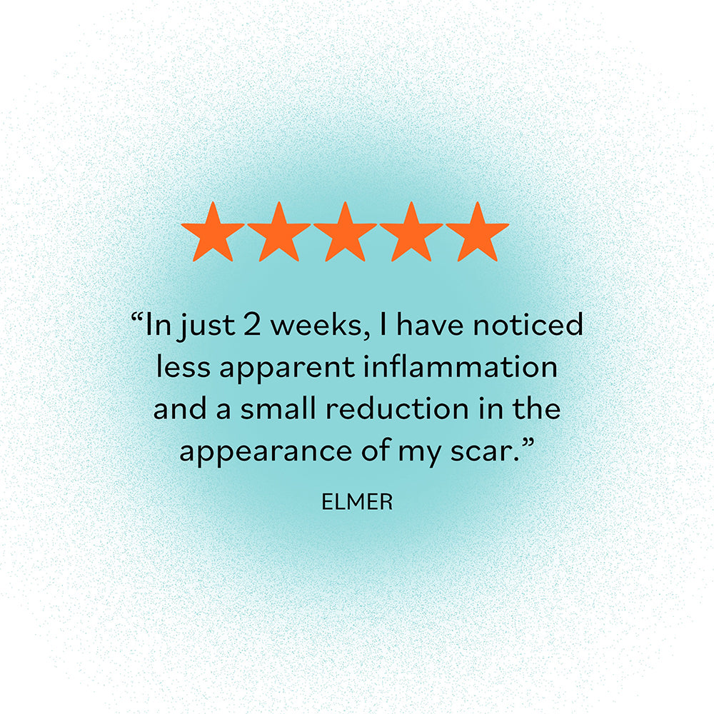 Five-star customer review for Derma E: 'In just 2 weeks, I have noticed less apparent inflammation and a small reduction in the appearance of my scar.' - Elmer.