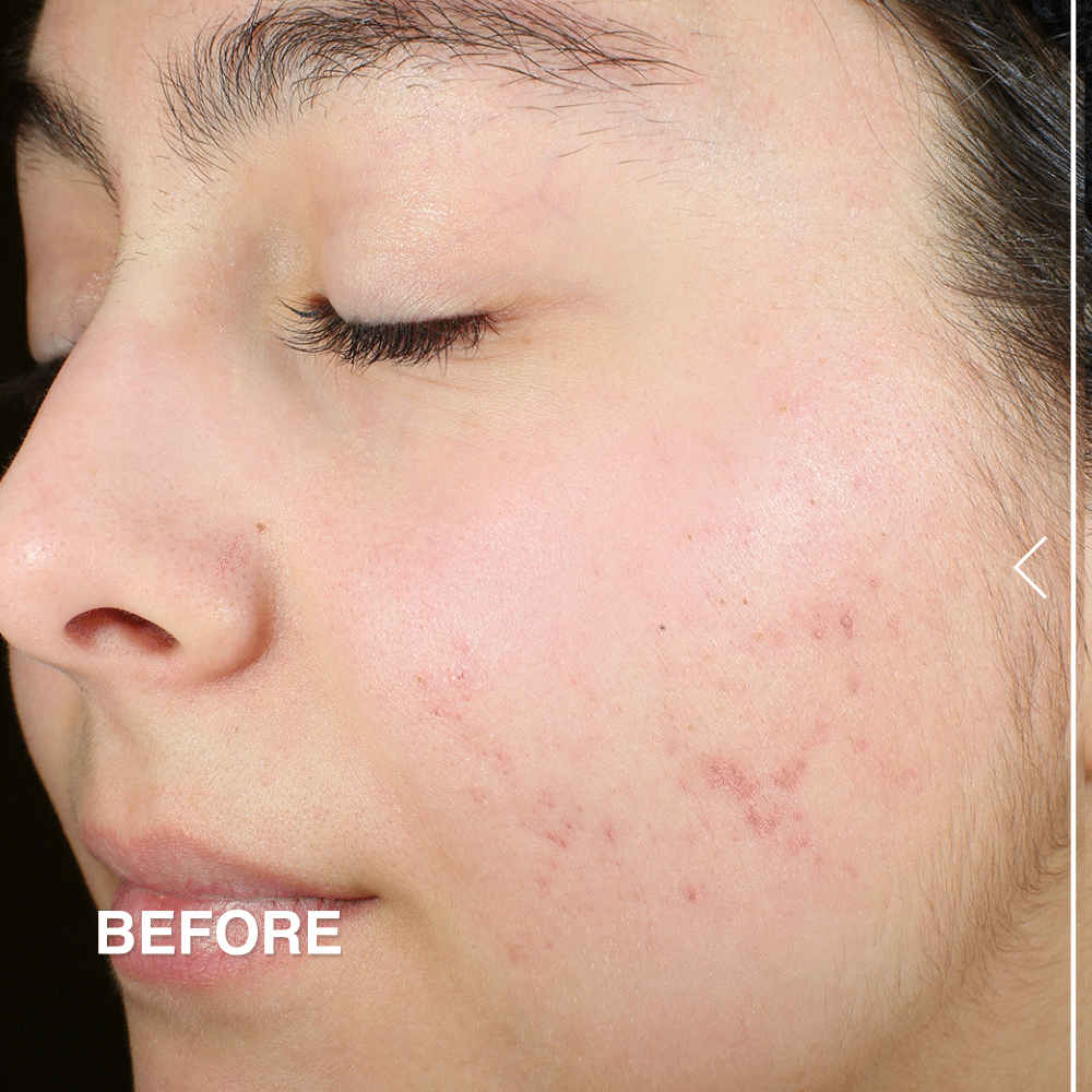 Sulfur Spot Treatment Clear Skin Overnight – DERMA E