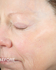 Advanced Peptides & Flora-Collagen™ Gentle Jelly Cleanser