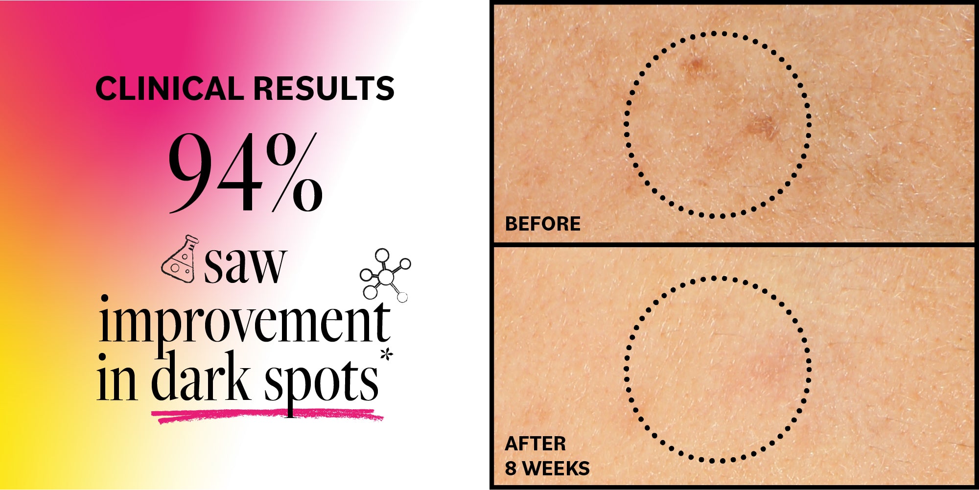 Advertisement showing clinical results of a skincare product with 'Before' and 'After' skin patches.