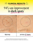 Vitamin C Concentrated Serum 