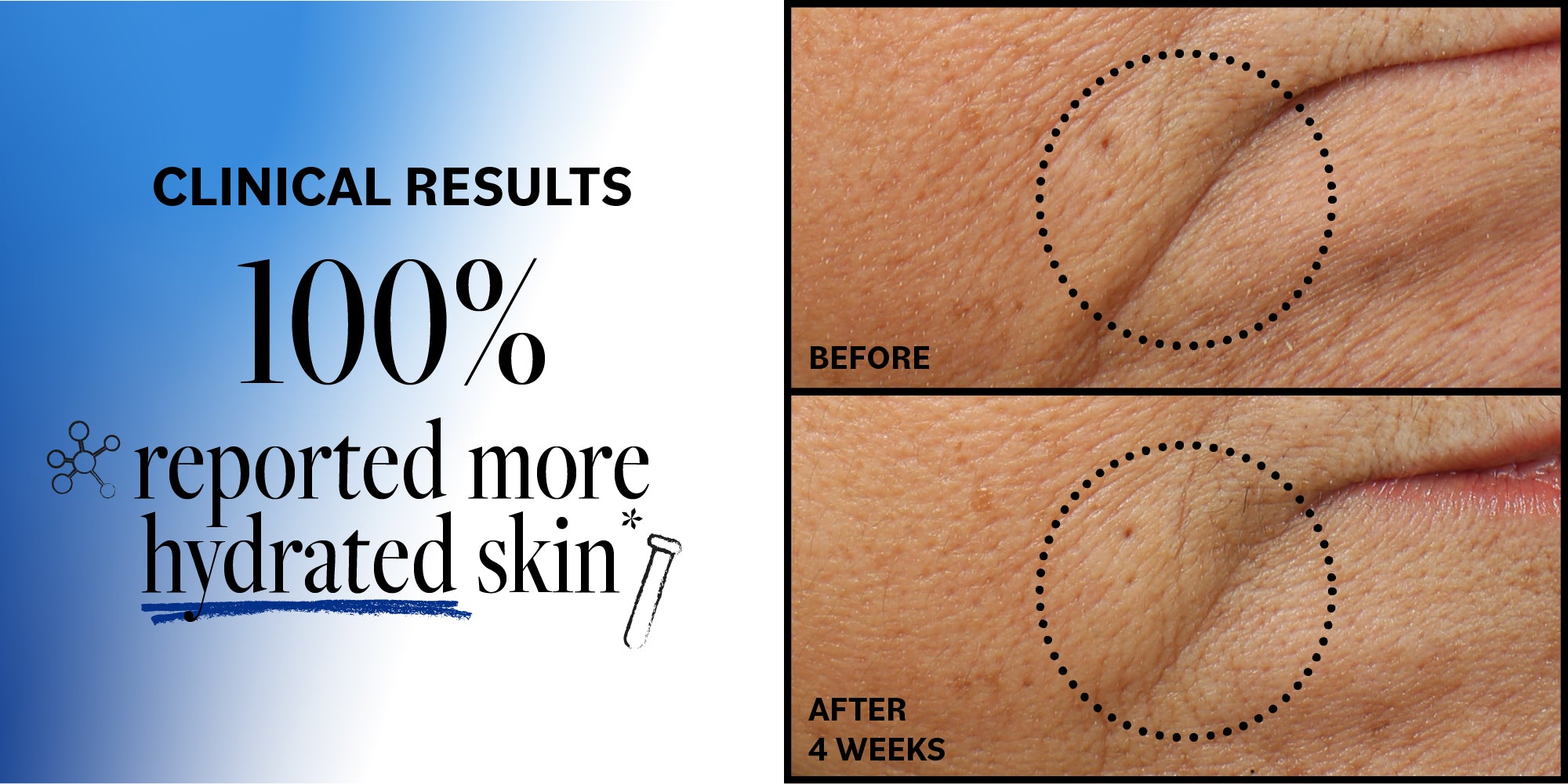 Advertisement showing clinical results of hydrated skin with 'Before' and 'After' comparisons.