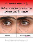 Before and after comparison of under-eye area with text highlighting improved texture and firmness.