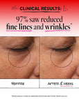 Before and after comparison of fine lines and wrinkles on skin with clinical results text.