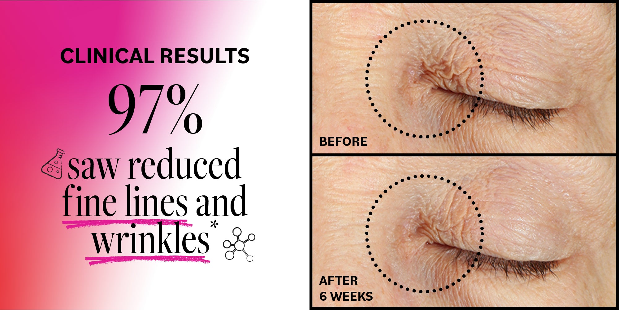 Advertisement showing clinical results of reduced fine lines and wrinkles with a before and after comparison on skin.