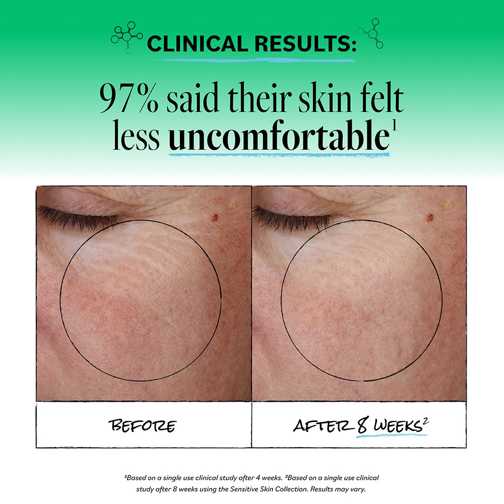Clinical results graphic showing a side-by-side before and after comparison of skin texture on the cheek, with text stating '97% said their skin felt less uncomfortable' on a green gradient background.