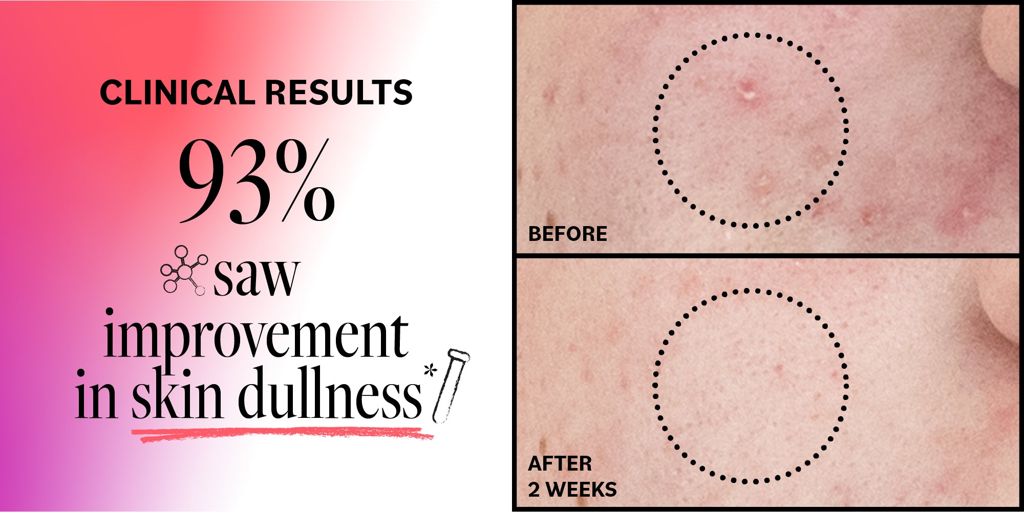Before and after skin improvement shown on a pink gradient background with text about clinical results.
