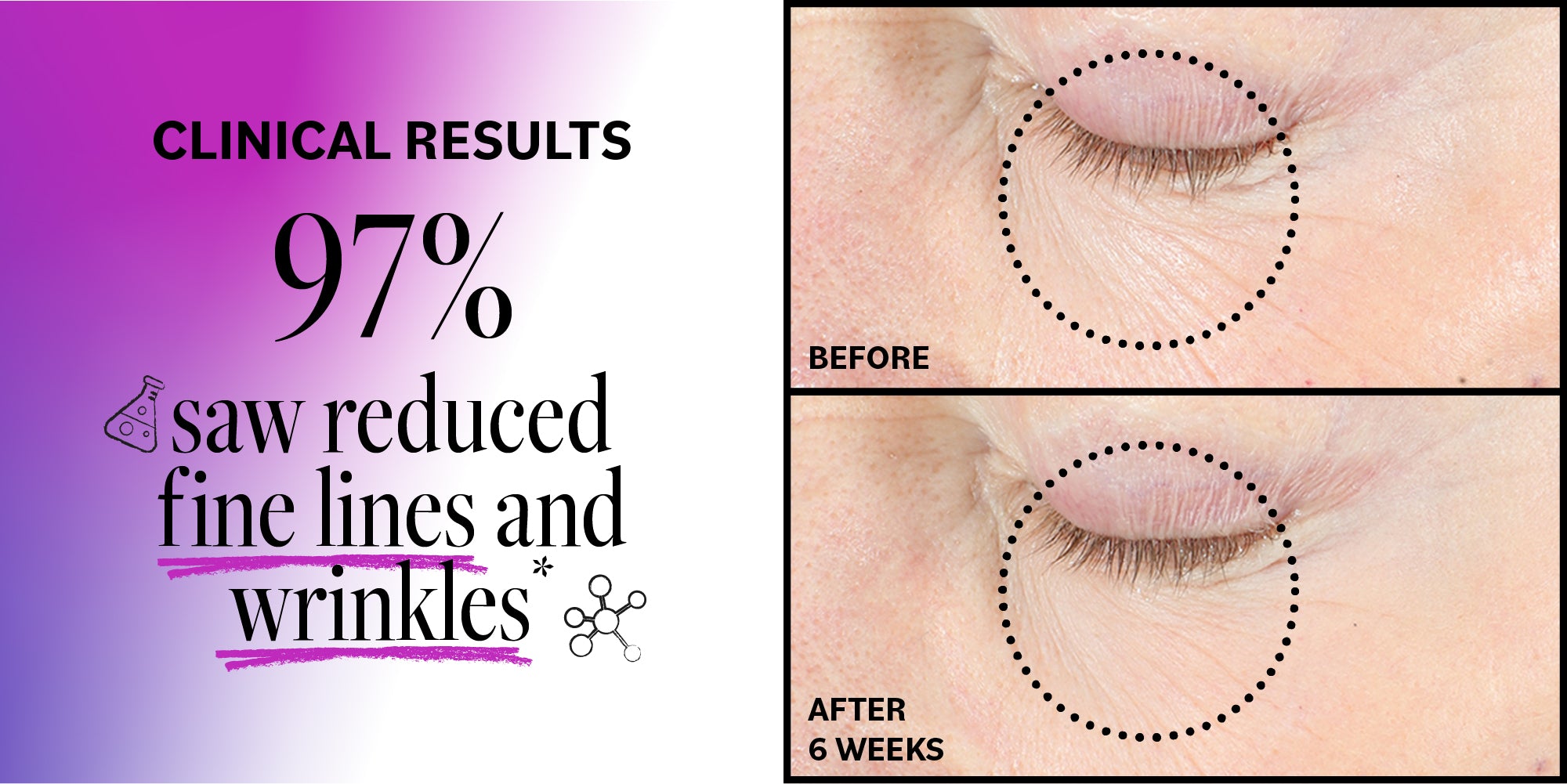 Advertisement showing clinical results of reduced fine lines and wrinkles with before and after images.