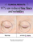Before and after comparison of eye area with text on clinical results.