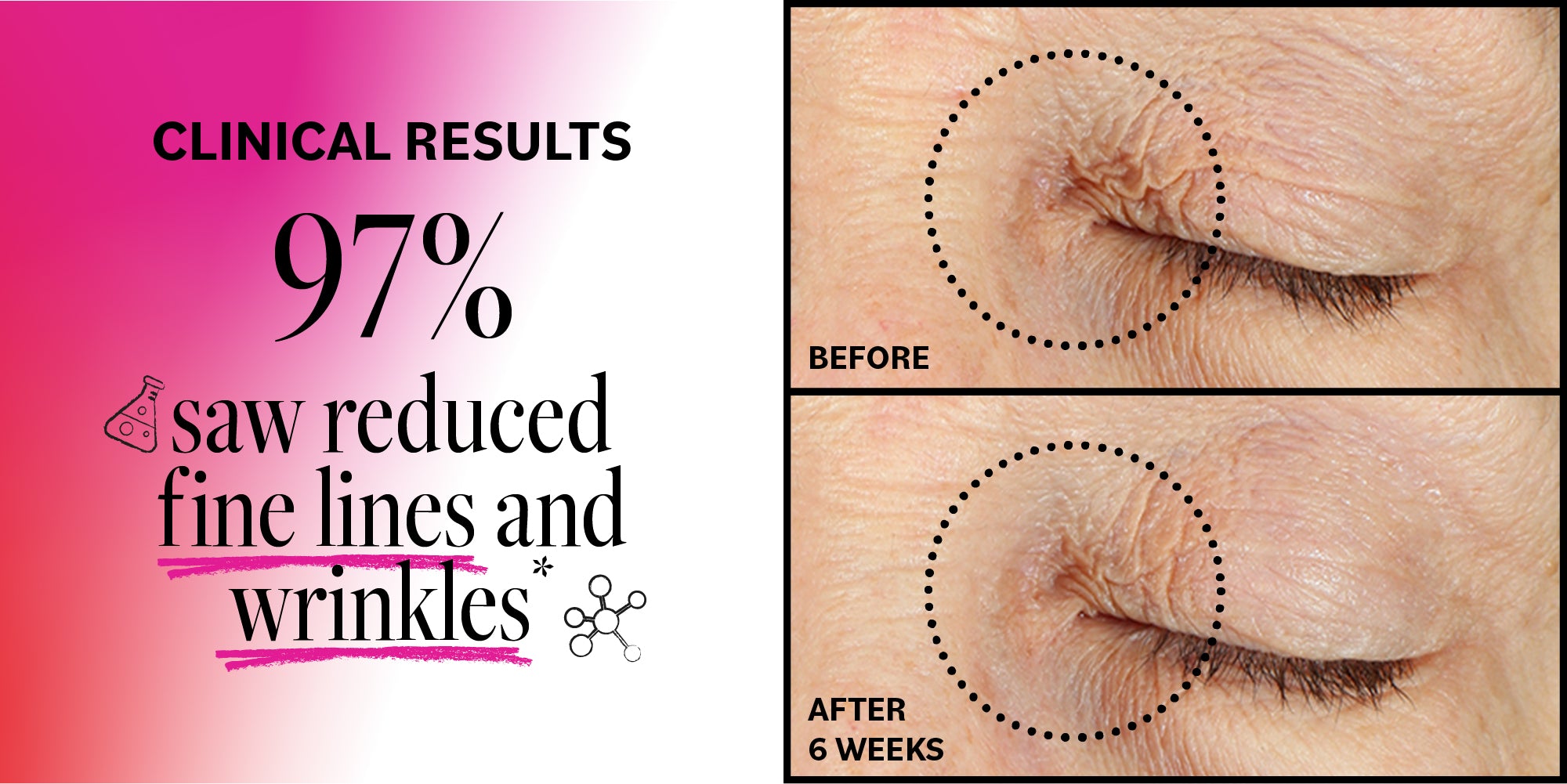 Advertisement showing clinical results of reduced fine lines and wrinkles with a before and after comparison on skin.