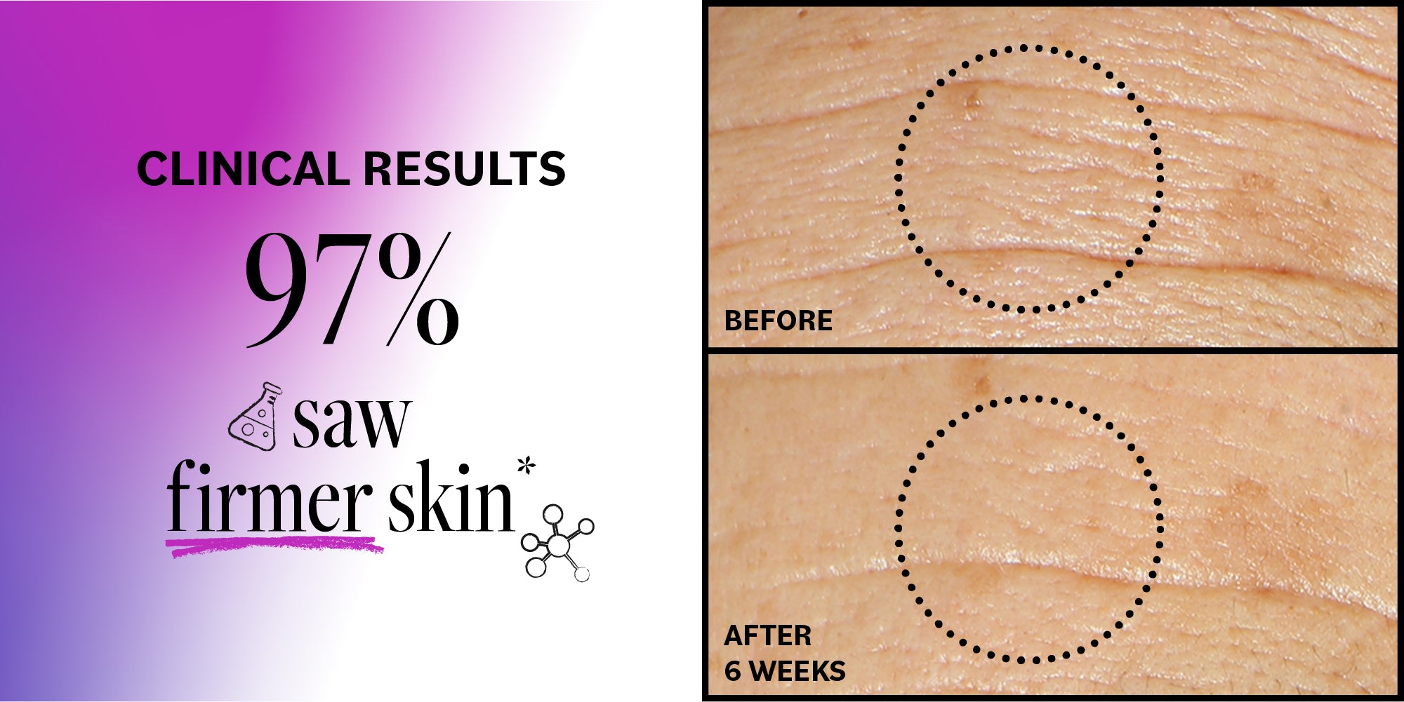 Advertisement showing clinical results of a skincare product with '97% saw firmer skin' text and before-and-after images on wooden surface.