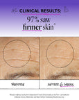 Before and after comparison of skin texture with clinical results on a purple background