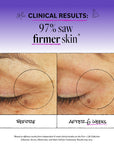 Stem Cell Eye Lifting Treatment