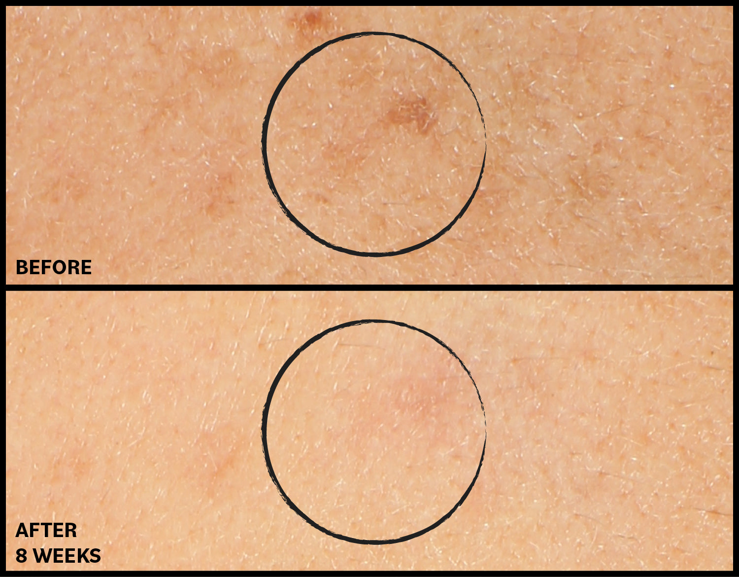 Before and after comparison of skin texture with a circle highlighting a spot on a beige background.