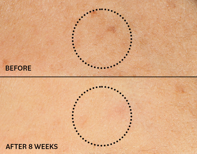 Before and after results showing 94% improvement in dark spots after 8 weeks of using Derma E Vitamin C Renewing Moisturizer, based on independent clinical study.