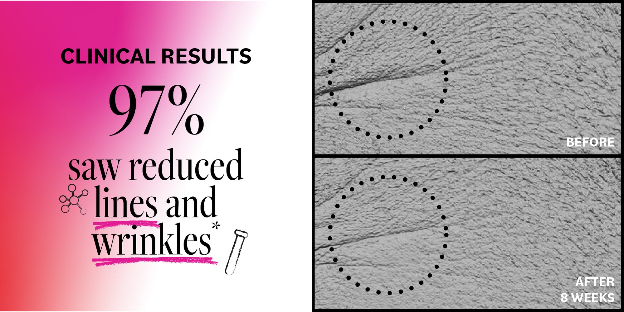 Advertisement showing clinical results with text and before-and-after skin comparisons.
