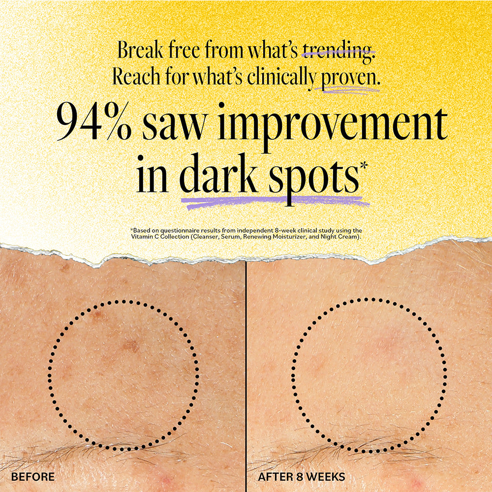 Before and after results showing 94% improvement in dark spots after 8 weeks of using Derma E Vitamin C Renewing Moisturizer, based on independent clinical study.