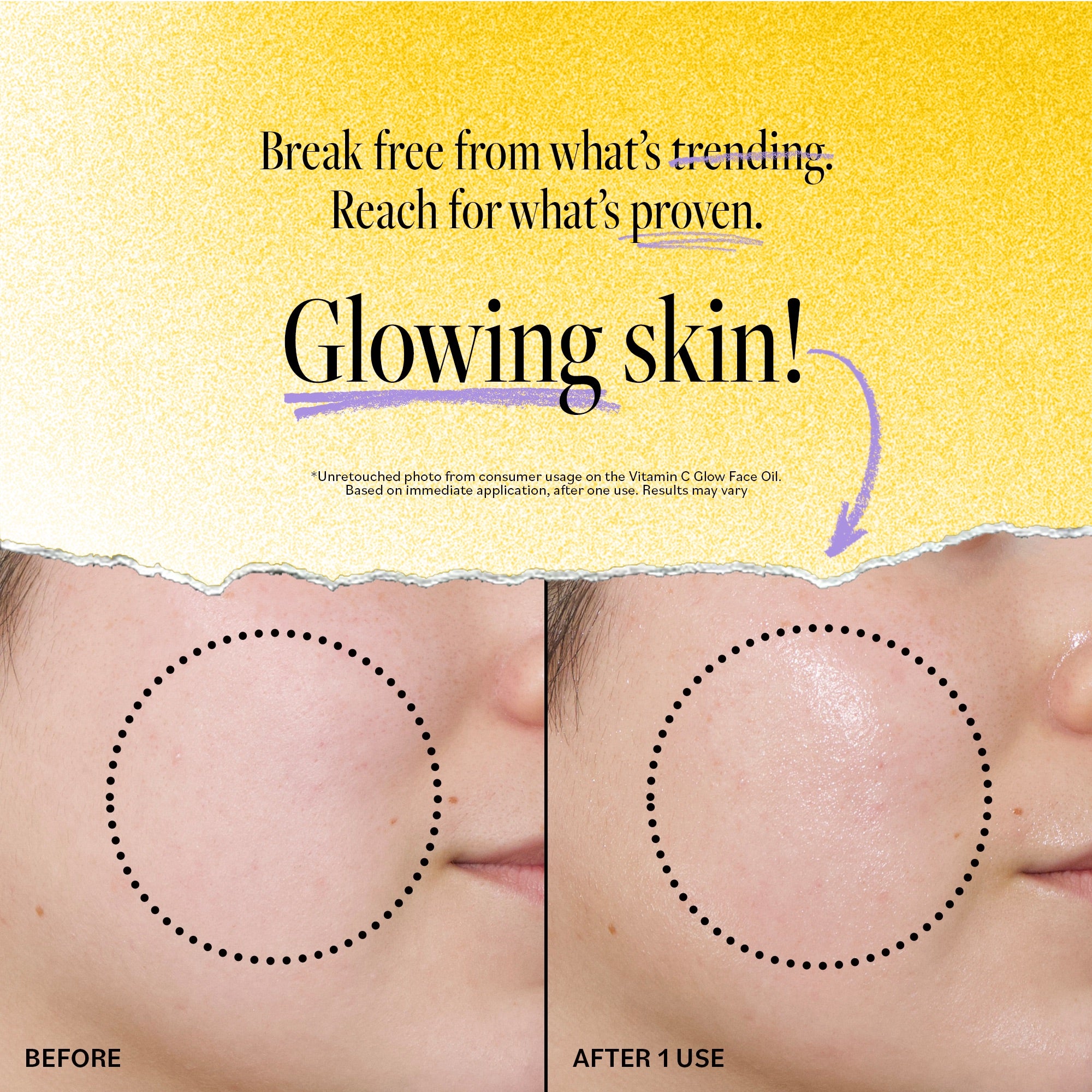 Before and after comparison showing glowing skin results from using Vitamin C Glow Face Oil. Text reads: &#39;Break free from what&#39;s trending. Reach for what&#39;s proven. Glowing skin!&#39; with visible improvement in skin texture and radiance after one use.