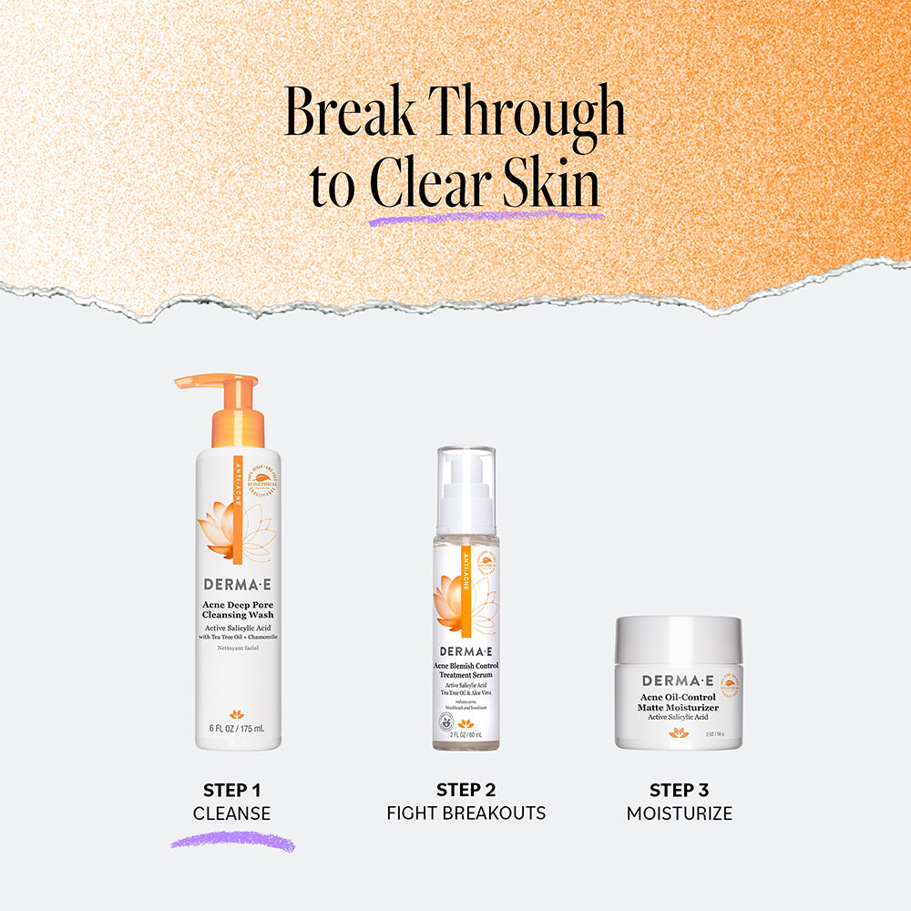 Acne Facial Cleanser