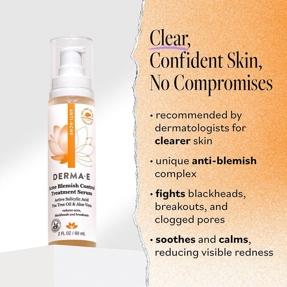 Acne Treatment Serum for Blemish Control