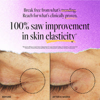 Stem Cell Lifting Eye Treatment