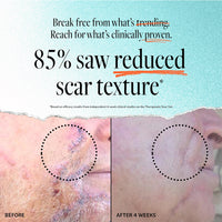 Scar Gel