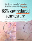 Before and after image showing reduced scar texture after 4 weeks of using Derma E Therapeutic Scar Gel, 85% saw reduced scar texture.